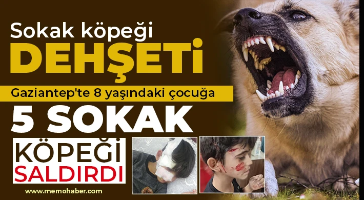 Gaziantep'te 8 yaşındaki çocuğa 5 sokak köpeği saldırdı