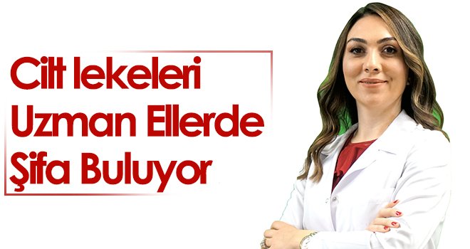 Cilt lekeleri uzman ellerde şifa buluyor