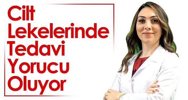 Cilt lekelerinde tedavi yorucu oluyor