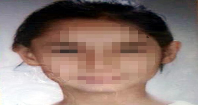 Babası Tokatlayınca 4Üncü Kattan Atladı