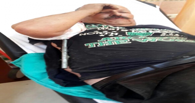 Oto Yıkama Tabancası Vücuduna Saplandı