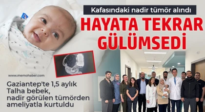 Gaziantep Şehir Hastanesi'nde 1,5 Aylık Bebeğe Dev Tümör Ameliyatı