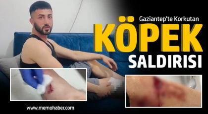 Nizip'te Korkutan Köpek Saldırısı: Berke Akkuş Taburcu Edildi