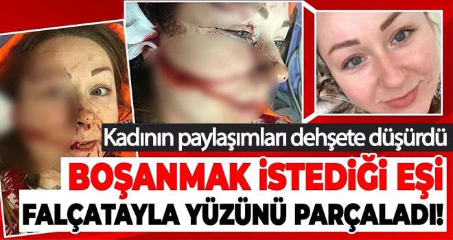 Falçatalı saldırıya uğrayan kadından sosyal medyada yardım çığlığı