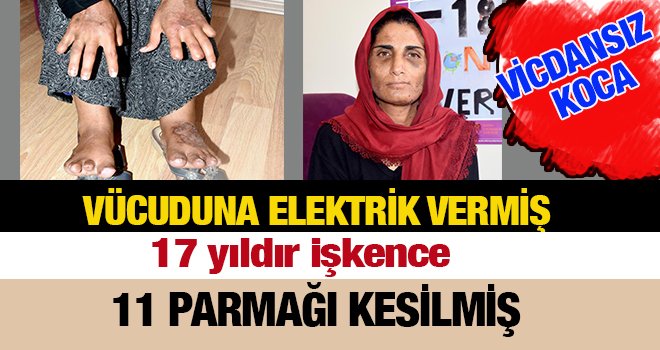 Gaziantepli eşinden görmediği şiddet kalmadı...